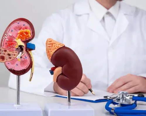 What to Expect During Kidney Transplant Recovery: A Step-by-Step Timeline
