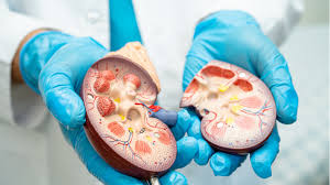 Kidney Transplant vs Dialysis: Key Differences, Benefits, and Risks