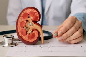 Laser Surgery for Kidney Stones